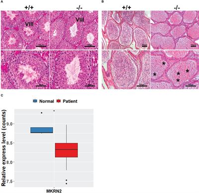 MKRN2 knockout causes male infertility through decreasing STAT1, SIX4, and TNC expression